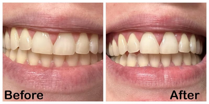 Hismile v34 Colour Corrector Serum img 3